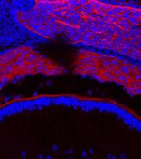 IF of a E 565 mouse cornea labeled with DSHB antibody CPTC-SAT1-2 against Spermidine or Spermine N1-Acetyltransferase 1 (red). Image credit: Lachke Laboratory, University of Delaware.